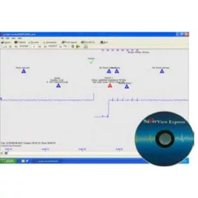 Szoftver Saver One defibrillátorhoz