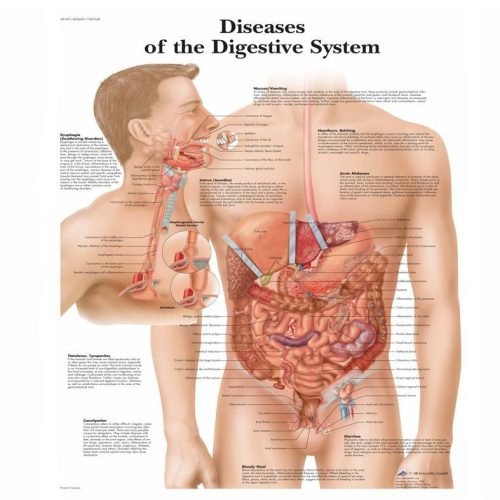 Faliposzter - emésztőrendszer (betegségek)
