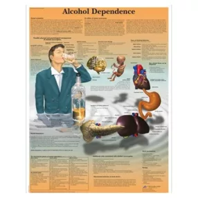 Alkohol függőség - angol