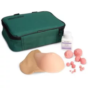 Mellvizsgáló készlet, daganattal