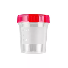 Nem steril vizeletgyűjtő pohár csavaros fedéllel, 120 ml