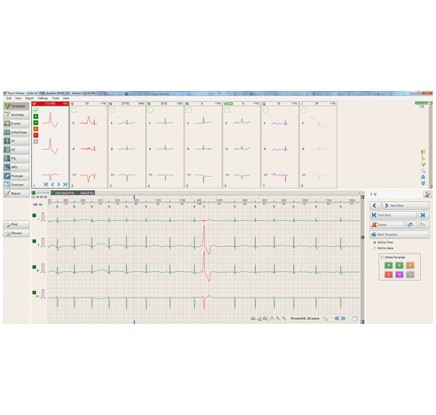 BTL CardioPoint Holter H100 szet