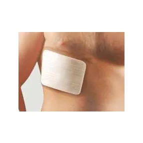 Chrisofix bordasín 2-3 borda