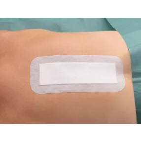   Cosmopor e steril sebfedő 10 cm x 6 cm (szigetkötszer hartmann) 25 db/doboz