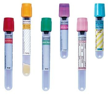 Vacutainer cső szérumanalízis piros 4 ml (369032) 13 x 75mm