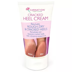 Carnation sarokbőr simító (repedés) krém 50 ml